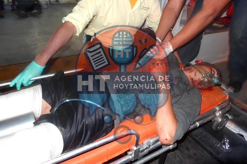 Inmigrante sufre amputación de brazo Inmigrante sufre amputación de brazo