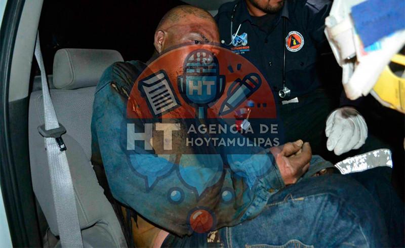 Sujeto al que le prendieron fuego Sujeto al que le prendieron fuego