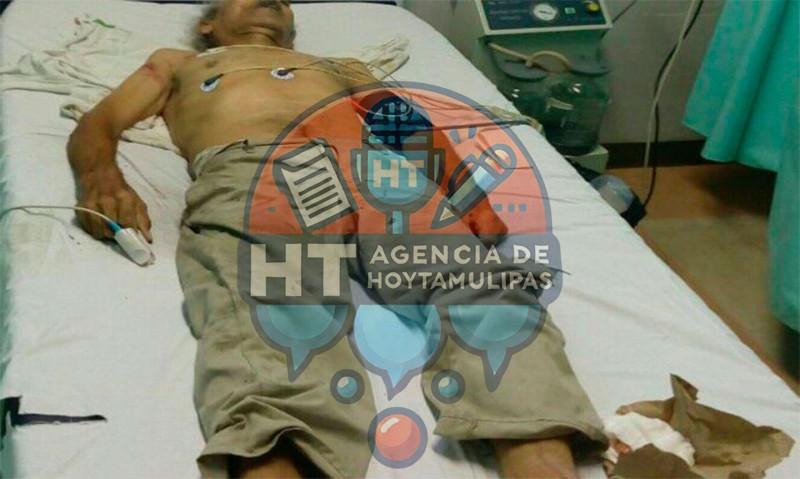 Muere anciano Muere anciano