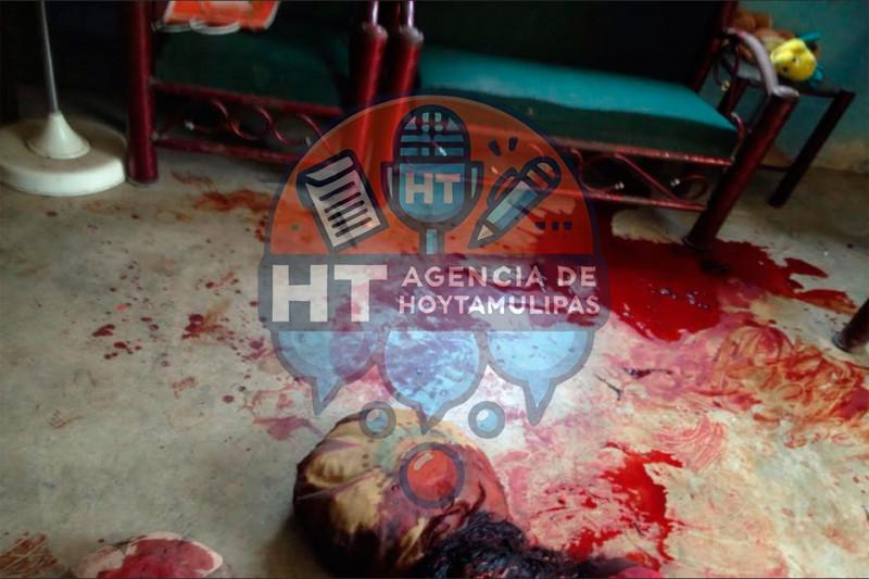 Macheteada Macheteada