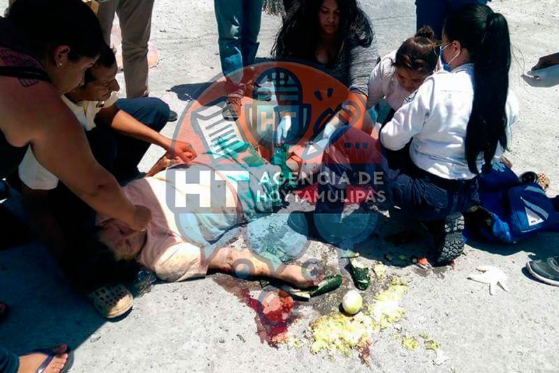 Mujer atropellada Mujer atropellada