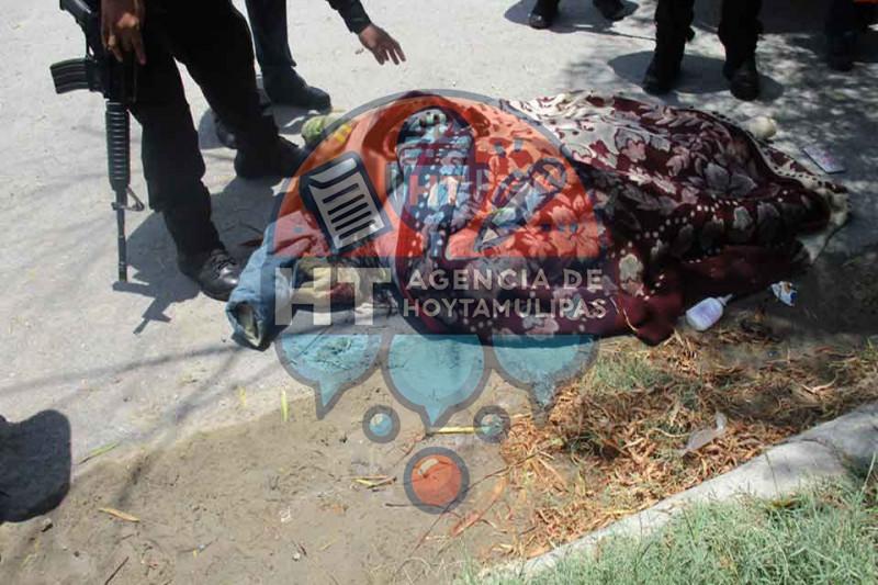 Sindrome de Down Sindrome de Down