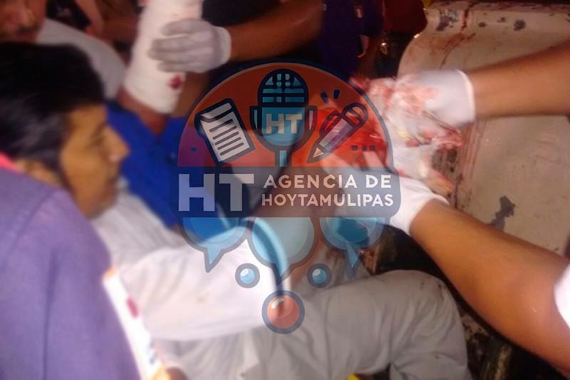 Amputas manos a empleado Amputas manos a empleado