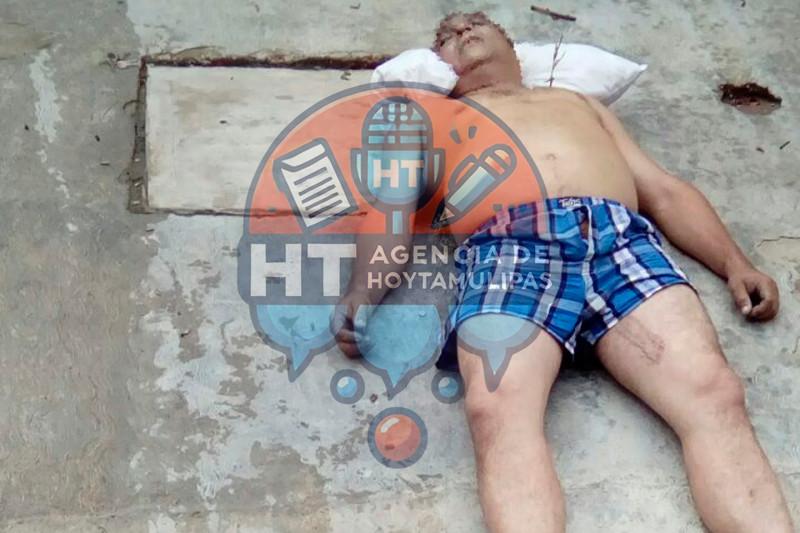 Hombre electrocutado Hombre electrocutado