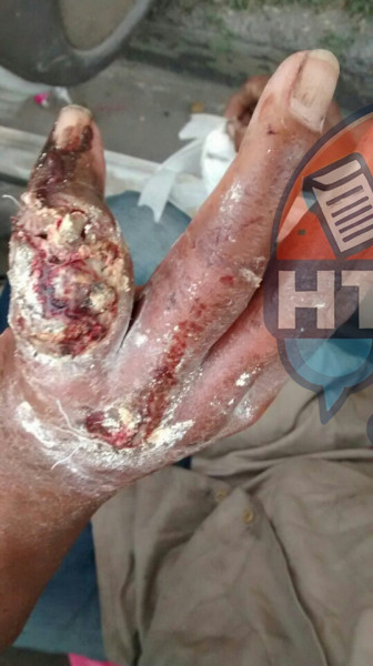 Oscar ten�a varios d�as �viviendo� en el veh�culo