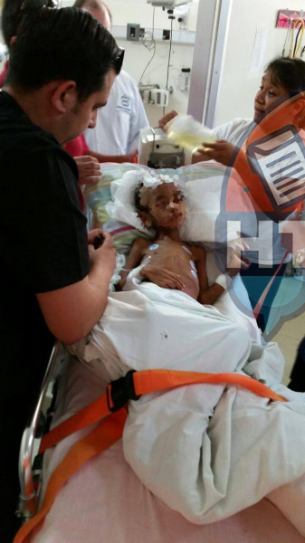 Pron�stico de Axel es de gravedad