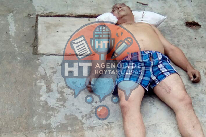 Hombre electrocutado 