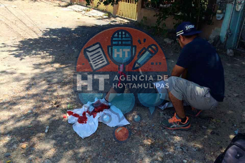 Adolescente se prensa un pie 