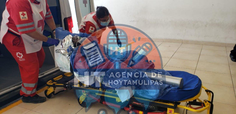 Param�dicos, mujer quemada 